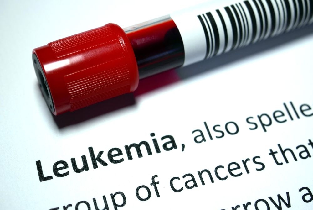 Fakta &amp;amp;amp; Mitos Seputar Penyakit Leukemia
